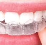 Merapikan Gigi Lebih nyaman Invisalign