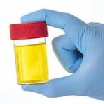 Mitos atau Fakta Minum Urine sendiri Bikin Tubuh Berenergi